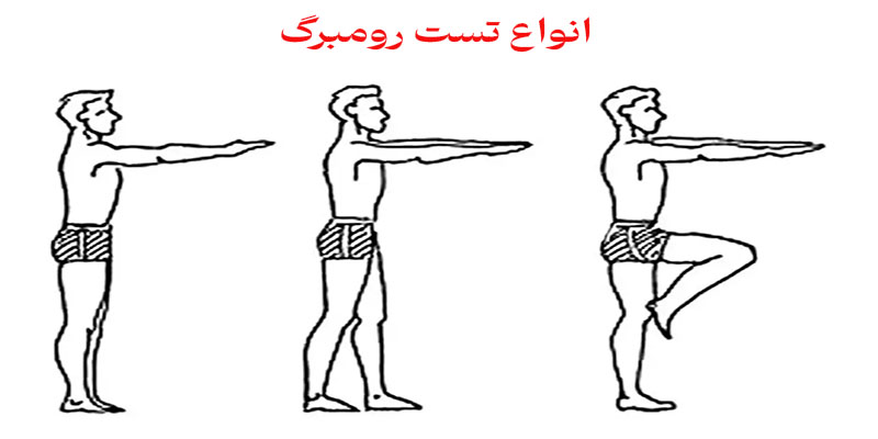 انواع تست رومبرگ