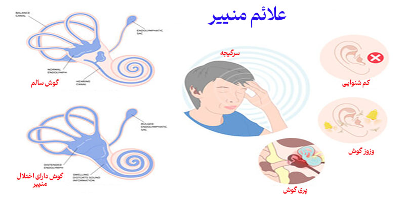 علائم منییر