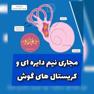 کریستال گوش