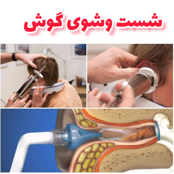 شست و شوی گوش