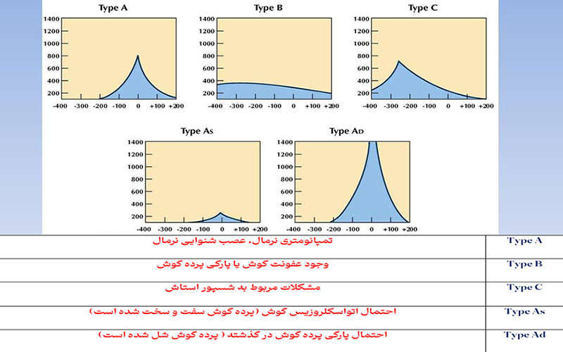 تفسیر نوار گوش کودکان